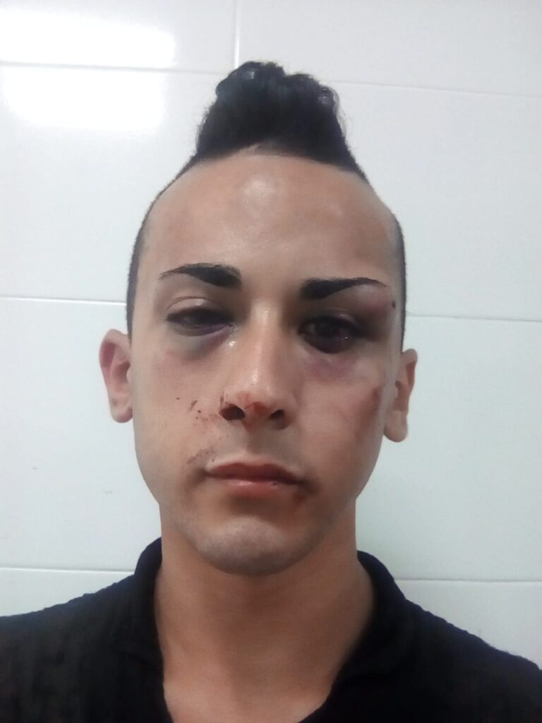 <span style='font-size:28px;'>Víctima de un violento acoso callejero</span><br> “No rompieron mi espíritu de lucha ni mi orgullo”